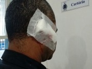 Guarda municipal é agredido a golpes de facão em Teixeira de Freitas